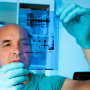 Western-blotting-nawah